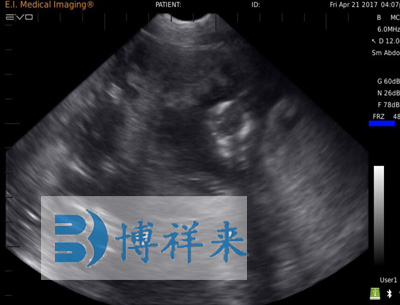 母猪40天怀孕B超图像