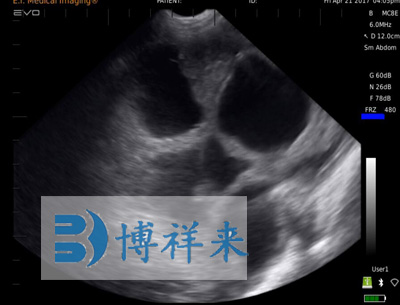 母猪25天怀孕B超图像