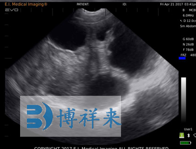 母猪30天怀孕B超图像