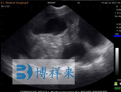 母猪35天怀孕B超图像