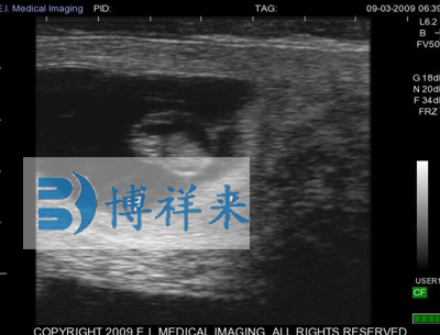 牛怀孕30天影像图