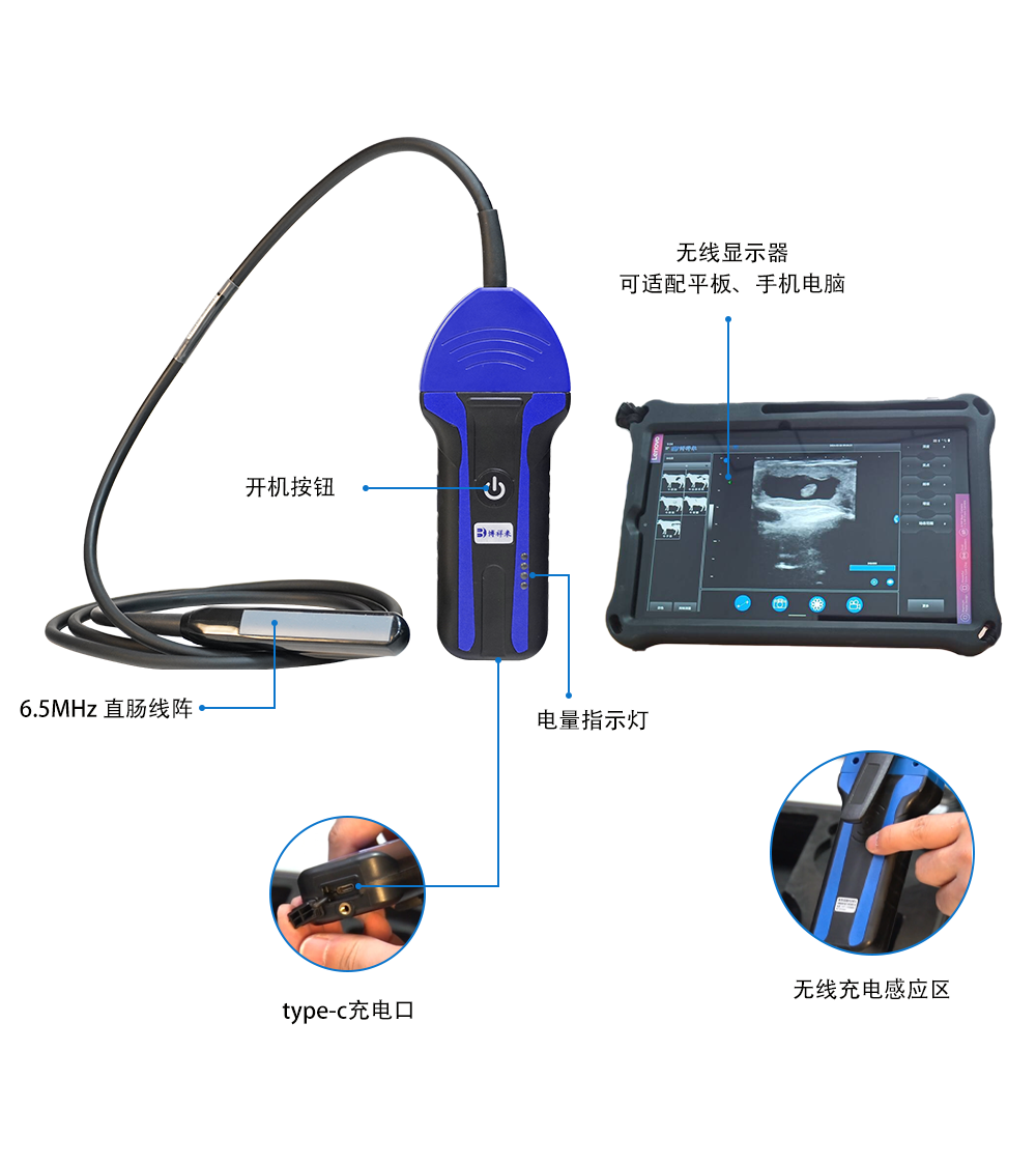 无线兽用B超机BXL-S100产品结构