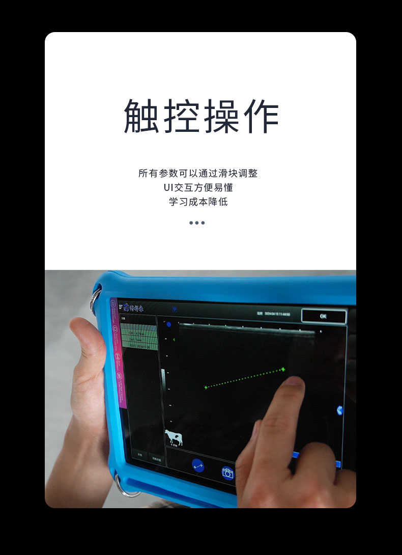 高清无线测孕仪B超仪