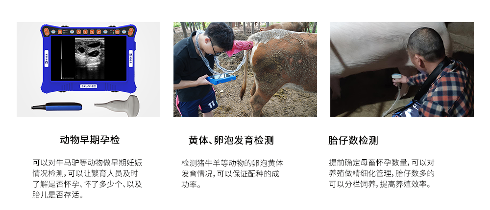 手用B超机产品功能