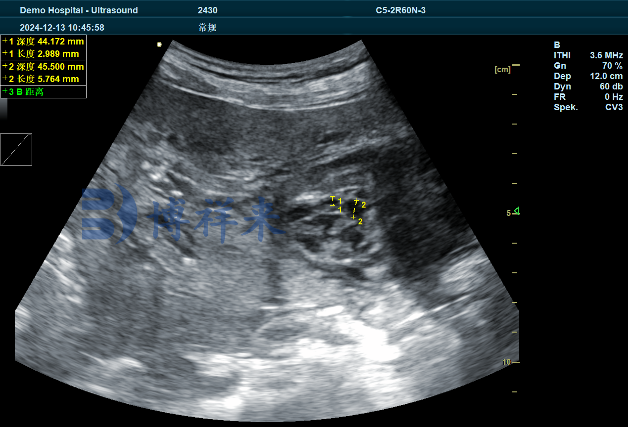 猪用B超机BXL-DZ20测母猪卵巢