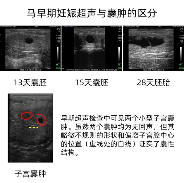 马B超早期妊娠图像和囊肿对比