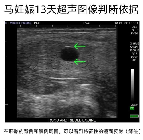 马B超13天超声图像特点